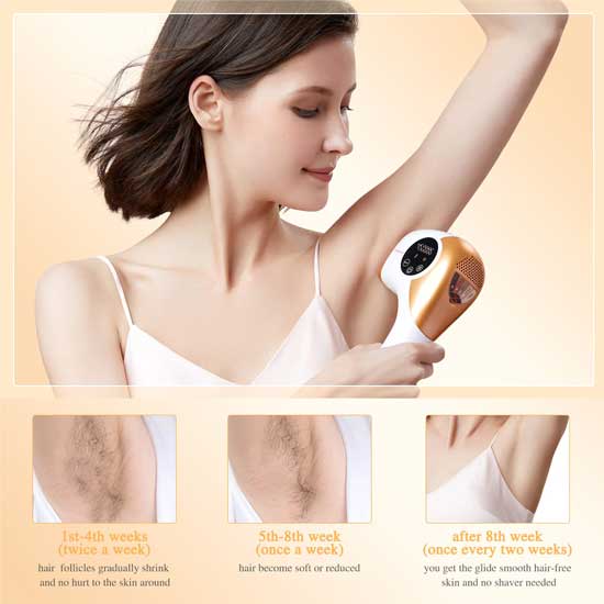 Hair Removal Machine At Home With 999k Flashes On Face, Armpit, Legs, Bikini Line, Body – Yamangu